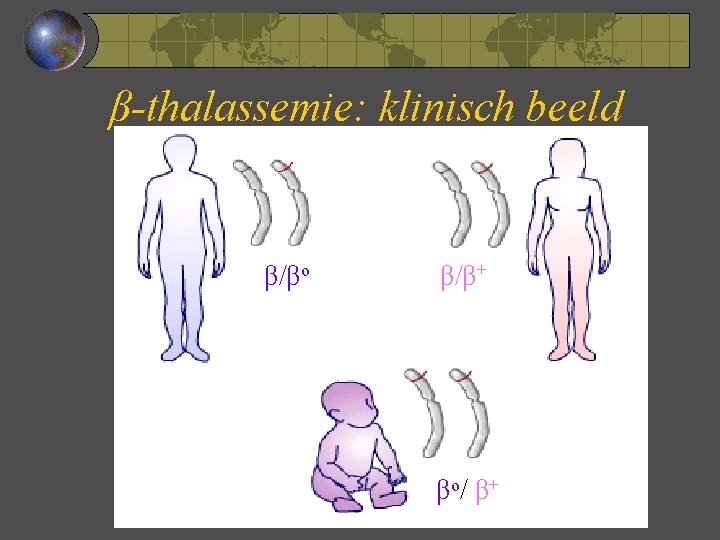 β-thalassemie: klinisch beeld β/βo β/β+ βo/ β+ 