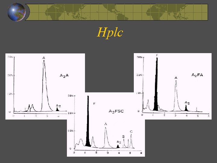 Hplc 