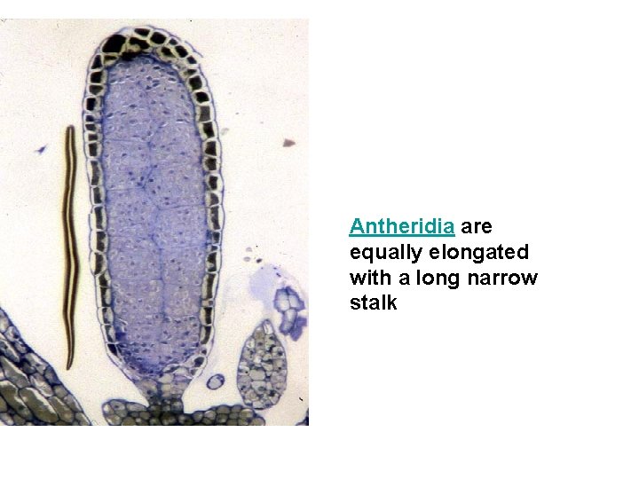 Antheridia are equally elongated with a long narrow stalk 