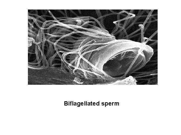 Biflagellated sperm 