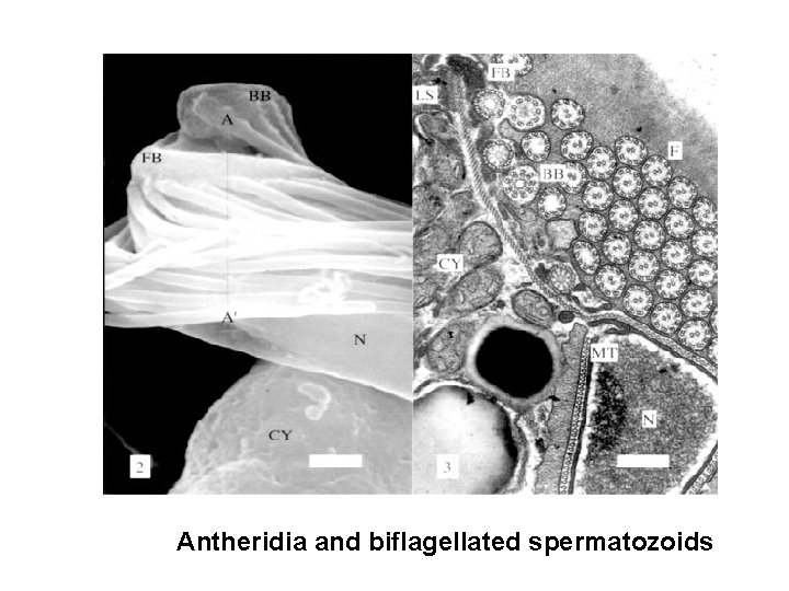 Antheridia and biflagellated spermatozoids 