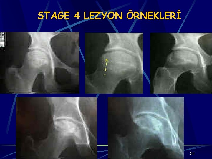 STAGE 4 LEZYON ÖRNEKLERİ 36 