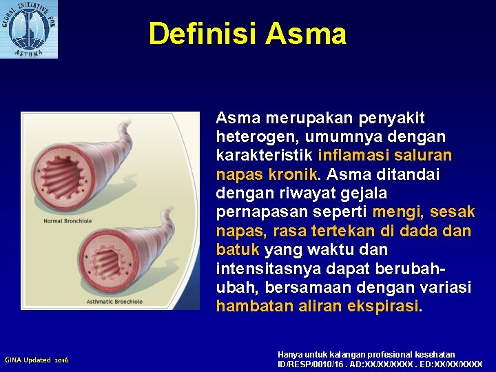 Definisi Asma merupakan penyakit heterogen, umumnya dengan karakteristik inflamasi saluran napas kronik. Asma ditandai