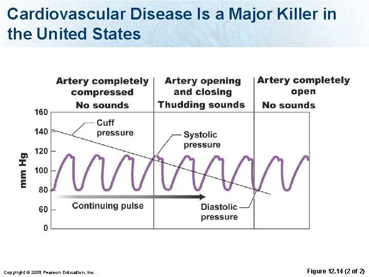 Cardiovascular Disease Is a Major Killer in the United States Copyright © 2009 Pearson