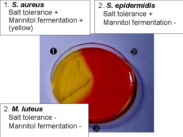 1. S. aureus Salt tolerance + Mannitol fermentation + (yellow) 2. M. luteus 1. S. aureus Salt tolerance + Mannitol fermentation + (yellow) 2. M. luteus