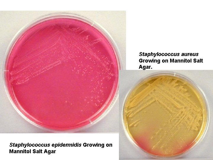 Staphylococcus aureus Growing on Mannitol Salt Agar. Staphylococcus epidermidis Growing on Mannitol Salt Agar Staphylococcus aureus Growing on Mannitol Salt Agar. Staphylococcus epidermidis Growing on Mannitol Salt Agar
