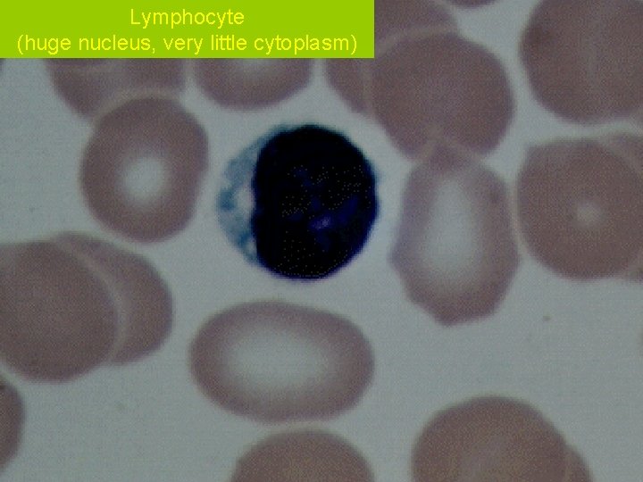 Lymphocyte (huge nucleus, very little cytoplasm) 