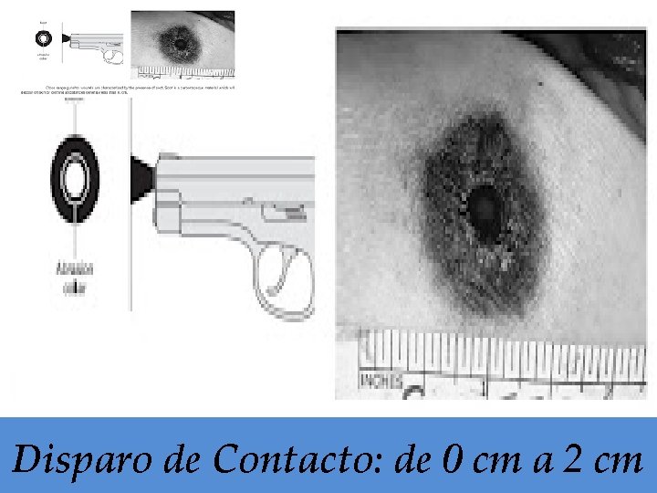Disparo de Contacto: de 0 cm a 2 cm 