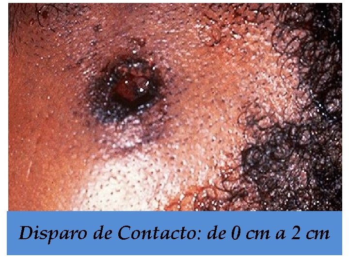 Disparo de Contacto: de 0 cm a 2 cm 