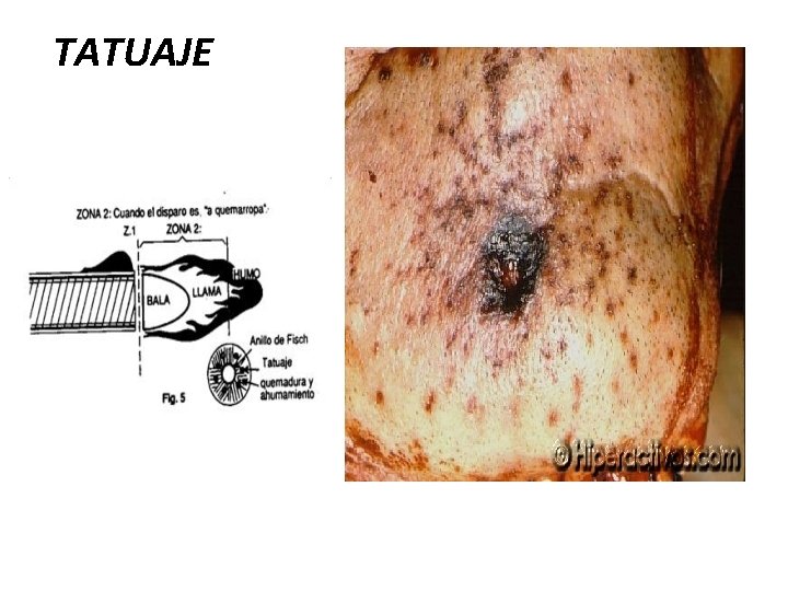TATUAJE 