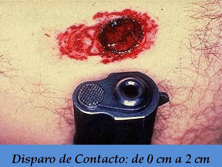 Disparo de Contacto: de 0 cm a 2 cm 