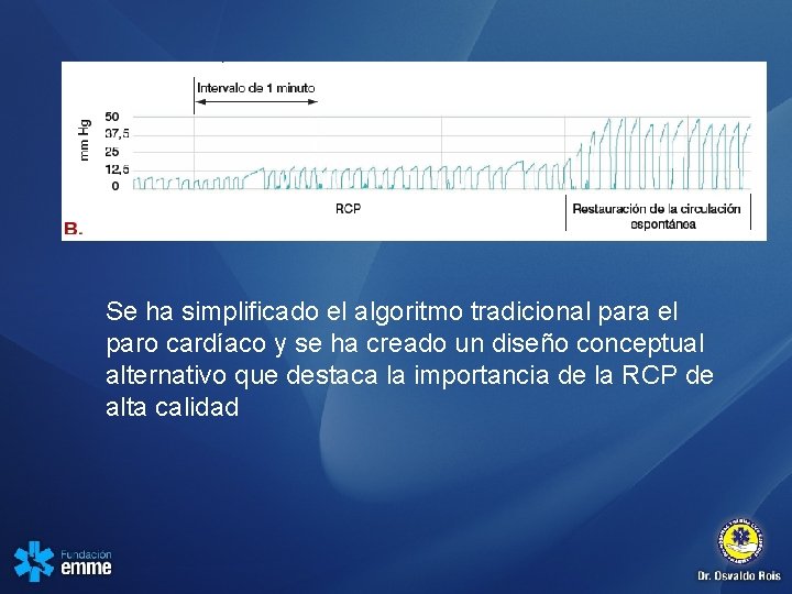 Se ha simplificado el algoritmo tradicional para el paro cardíaco y se ha creado