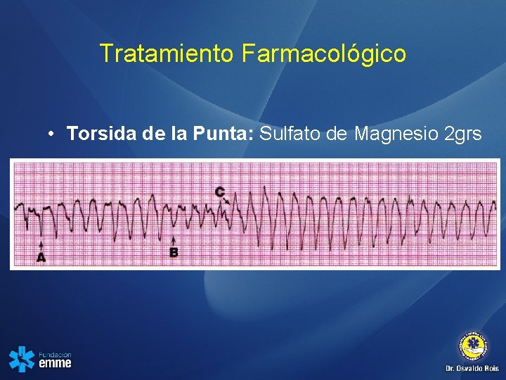 Tratamiento Farmacológico • Torsida de la Punta: Sulfato de Magnesio 2 grs 