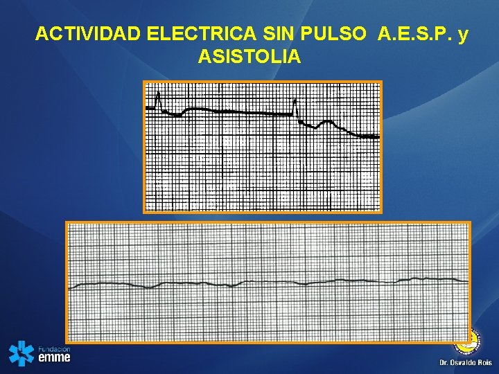 ACTIVIDAD ELECTRICA SIN PULSO A. E. S. P. y ASISTOLIA 