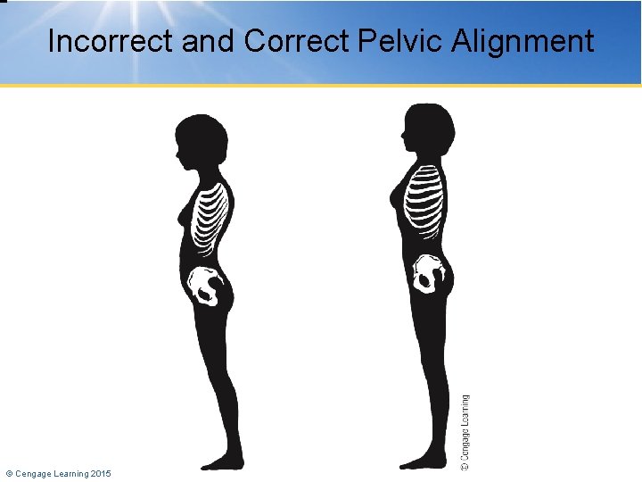 Incorrect and Correct Pelvic Alignment © Cengage Learning 2015 