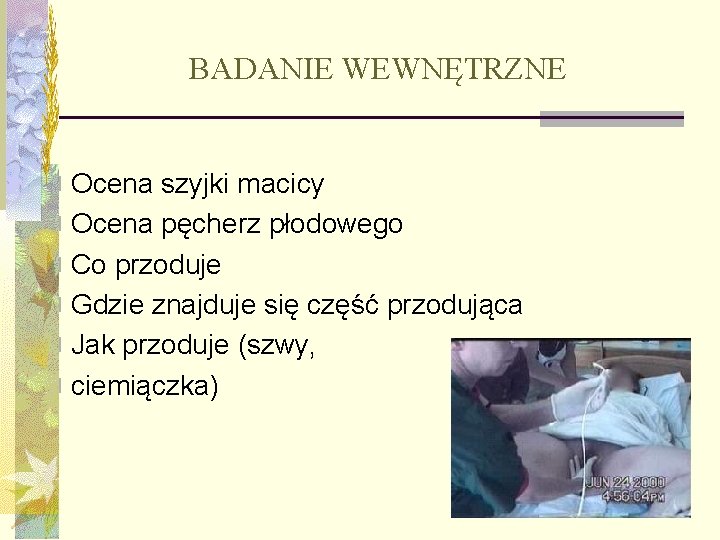 BADANIE WEWNĘTRZNE n Ocena szyjki macicy n Ocena pęcherz płodowego n Co przoduje n