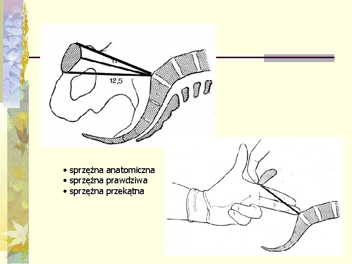  • sprzężna anatomiczna • sprzężna prawdziwa • sprzężna przekątna 