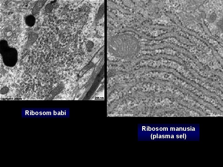 Ribosom babi Ribosom manusia (plasma sel) 