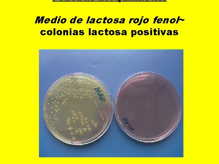 Pruebas bioquímicas: Medio de lactosa rojo fenol~ colonias lactosa positivas 