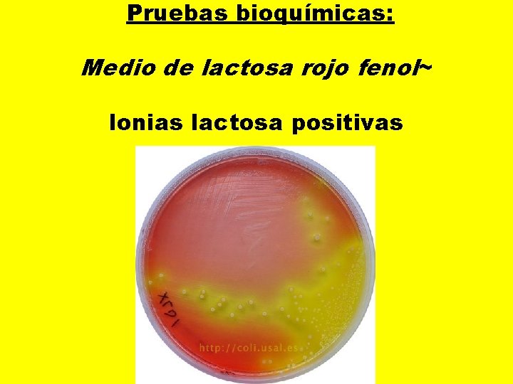  Pruebas bioquímicas: Medio de lactosa rojo fenol~ lonias lactosa positivas 