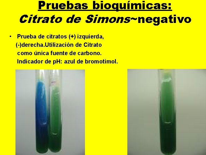 Pruebas bioquímicas: Citrato de Simons~negativo • Prueba de citratos (+) izquierda, (-)derecha. Utilización de