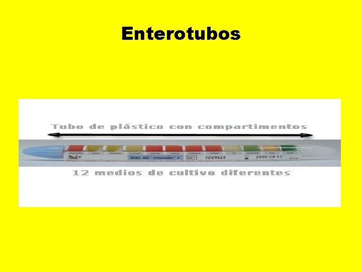 Enterotubos 