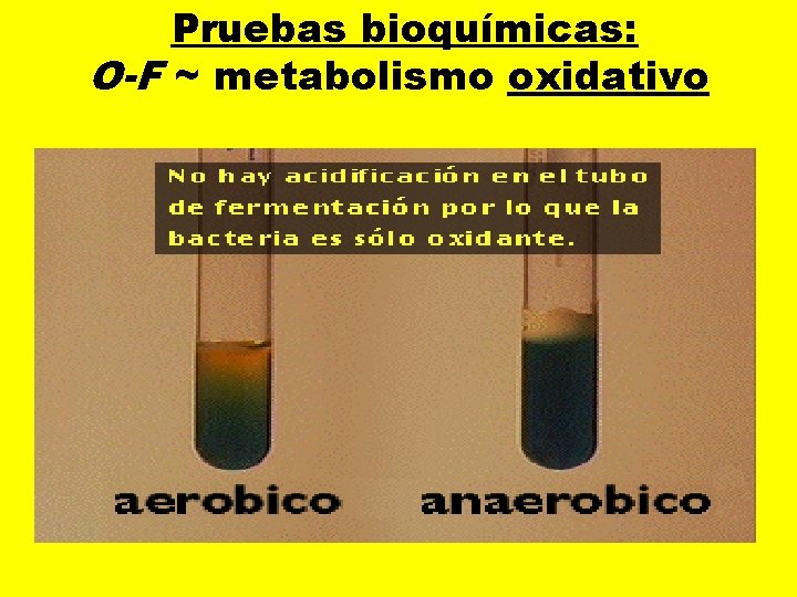  Pruebas bioquímicas: O-F ~ metabolismo oxidativo 