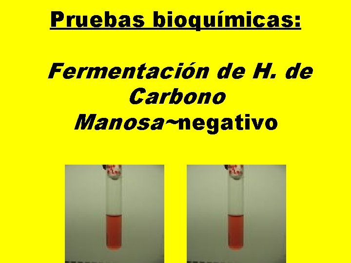 Pruebas bioquímicas: Fermentación de H. de Carbono Manosa~negativo 