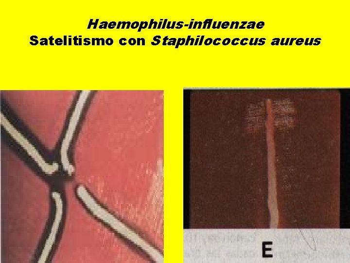 Haemophilus-influenzae Satelitismo con Staphilococcus aureus 