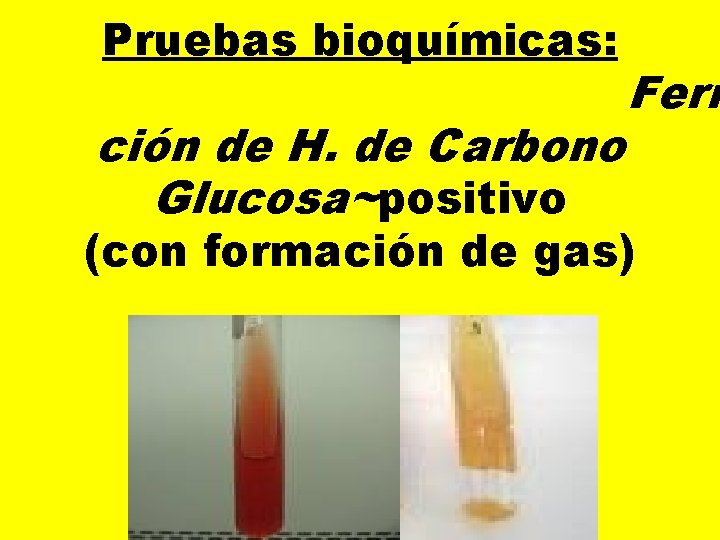 Pruebas bioquímicas: ción de H. de Carbono Glucosa~positivo Ferm (con formación de gas) 