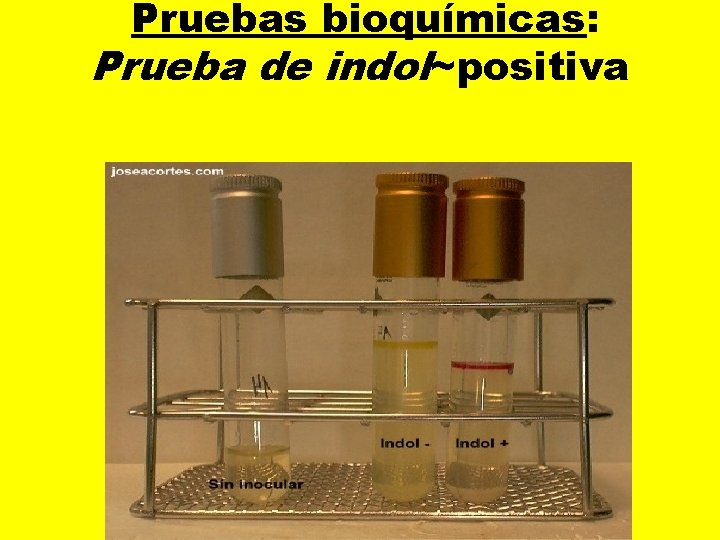  Pruebas bioquímicas: Prueba de indol~positiva 