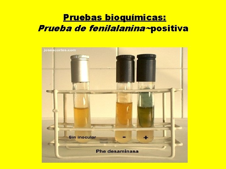  Pruebas bioquímicas: Prueba de fenilalanina~positiva 