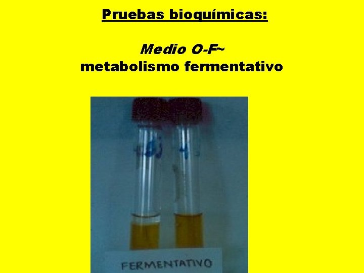  Pruebas bioquímicas: Medio O-F~ metabolismo fermentativo 