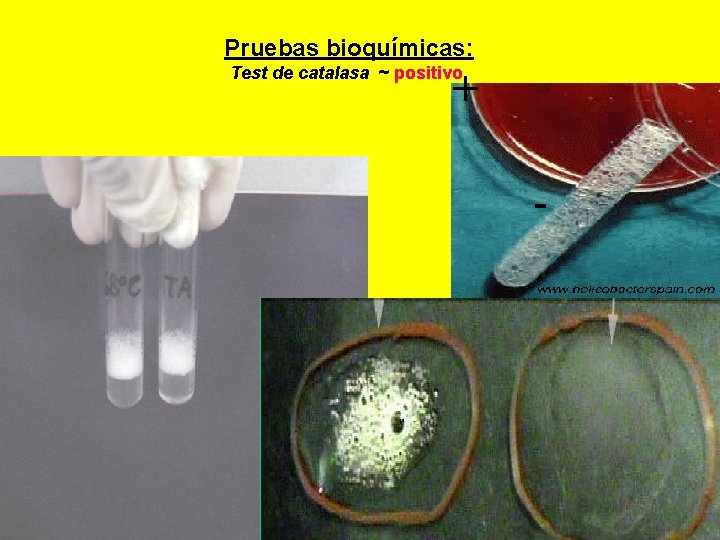  Pruebas bioquímicas: Test de catalasa ~ positivo + - 