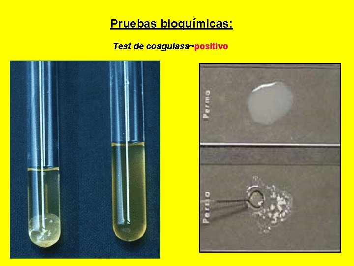  Pruebas bioquímicas: Test de coagulasa~positivo 