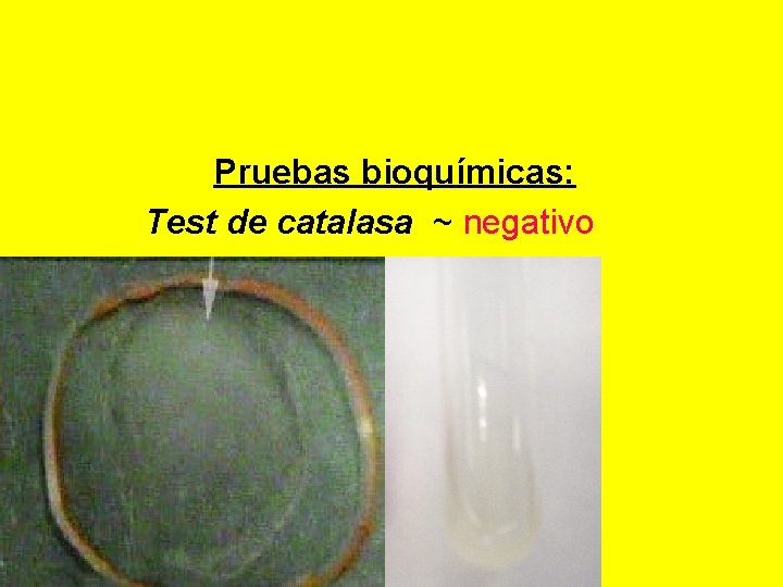  Pruebas bioquímicas: Test de catalasa ~ negativo 