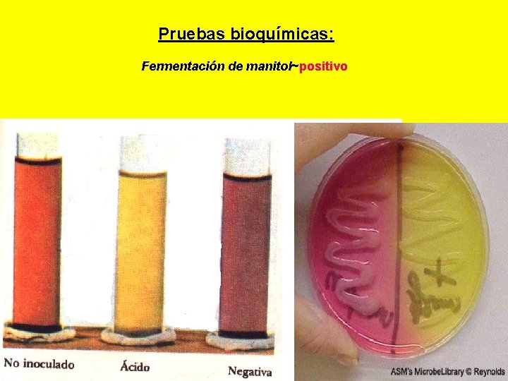  Pruebas bioquímicas: Fermentación de manitol~positivo 