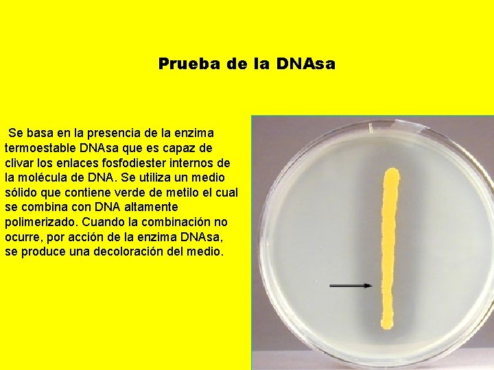 Prueba de la DNAsa Se basa en la presencia de la enzima termoestable DNAsa