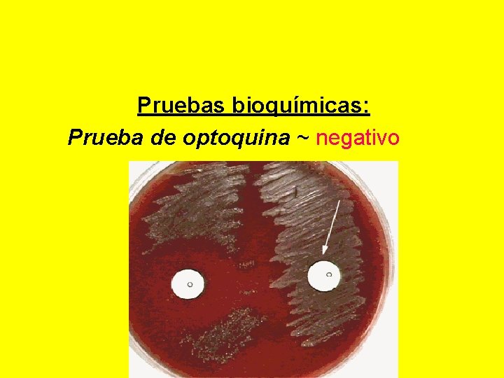  Pruebas bioquímicas: Prueba de optoquina ~ negativo 