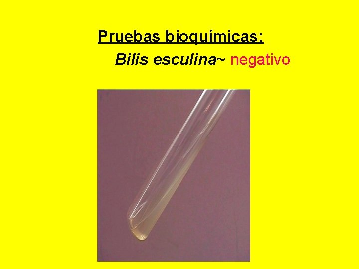 Pruebas bioquímicas: Bilis esculina~ negativo 
