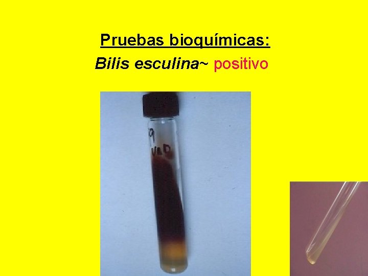  Pruebas bioquímicas: Bilis esculina~ positivo 