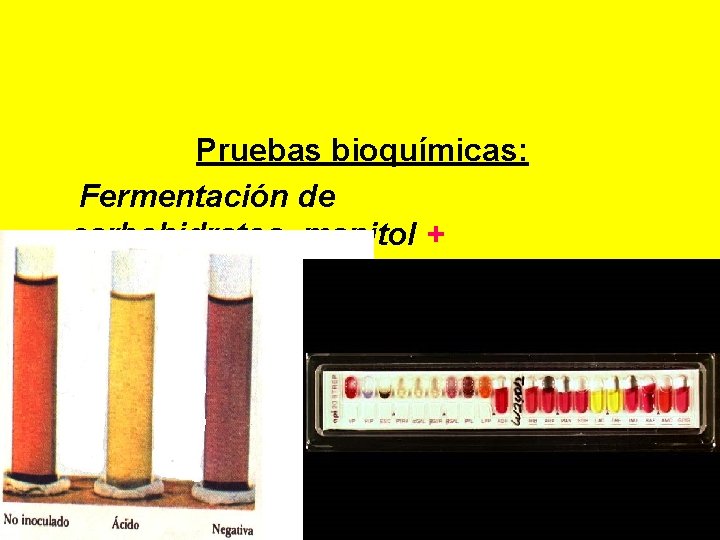  Pruebas bioquímicas: Fermentación de carbohidratos~manitol + (API) 