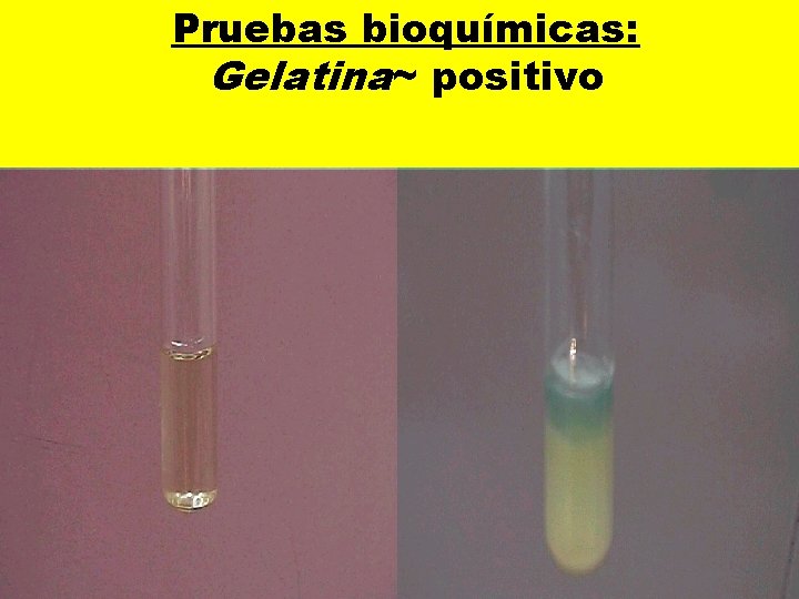  Pruebas bioquímicas: Gelatina~ positivo 