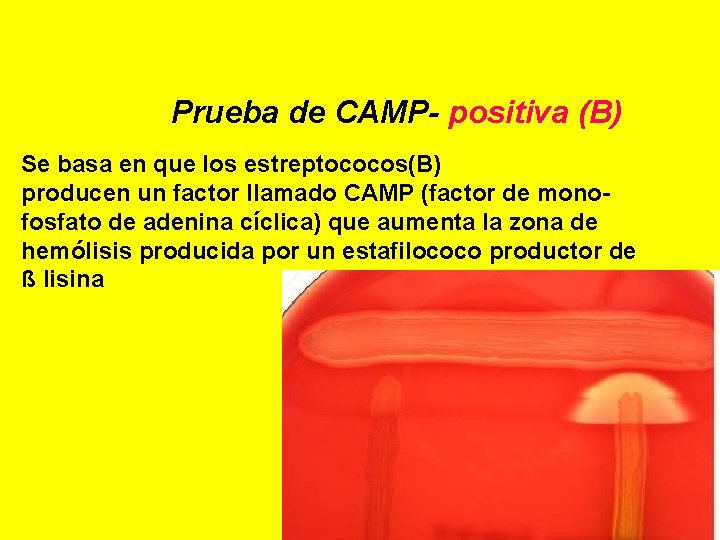 Prueba de CAMP- positiva (B) Se basa en que los estreptococos(B) producen un factor