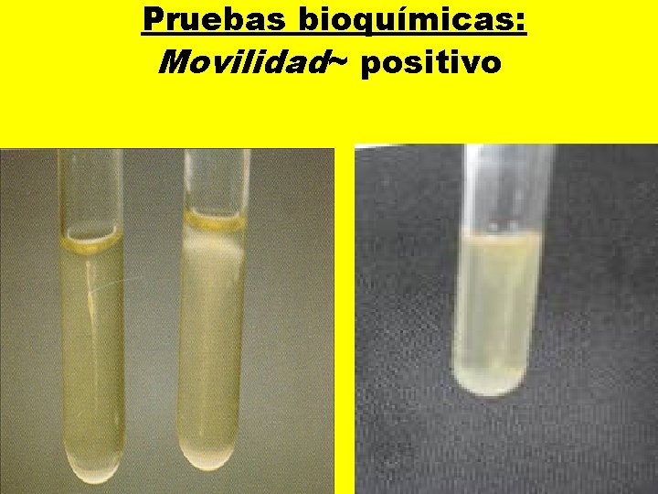  Pruebas bioquímicas: Movilidad~ positivo 