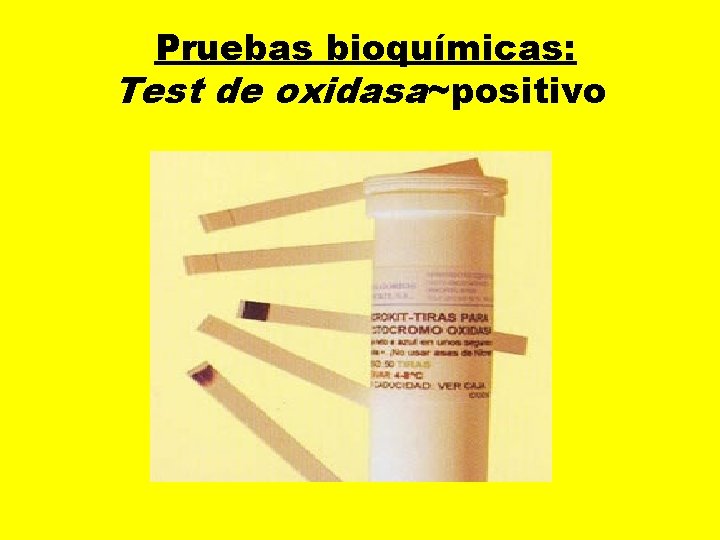  Pruebas bioquímicas: Test de oxidasa~positivo 