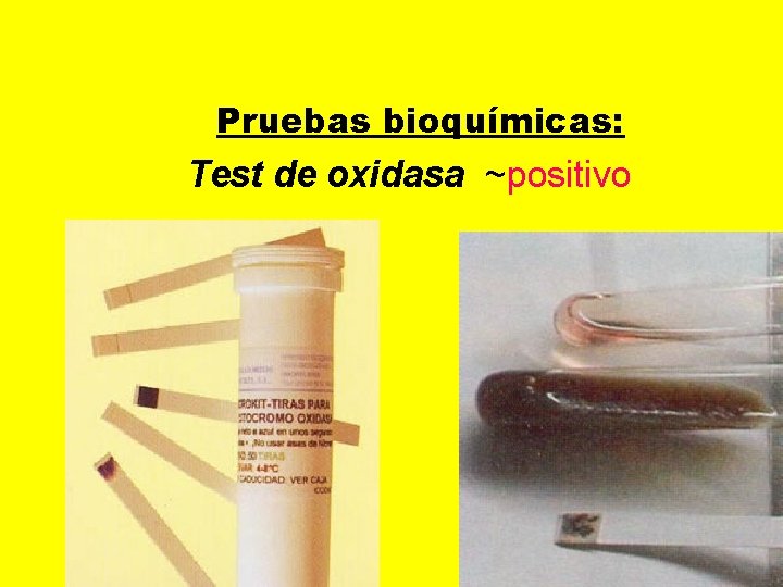 Pruebas bioquímicas: Test de oxidasa ~positivo 