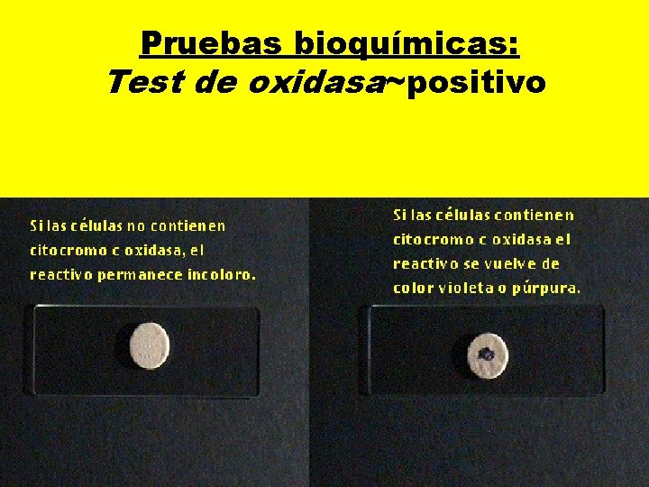  Pruebas bioquímicas: Test de oxidasa~positivo 