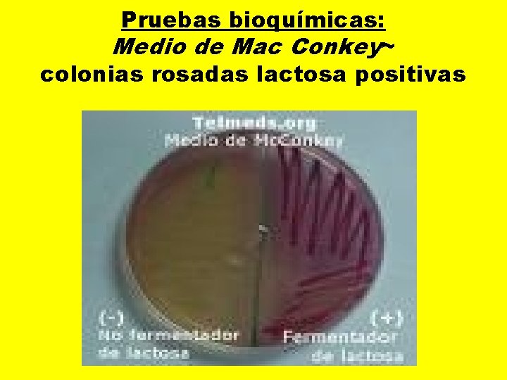 Pruebas bioquímicas: Medio de Mac Conkey~ colonias rosadas lactosa positivas 