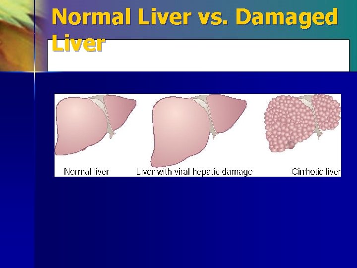 Normal Liver vs. Damaged Liver 